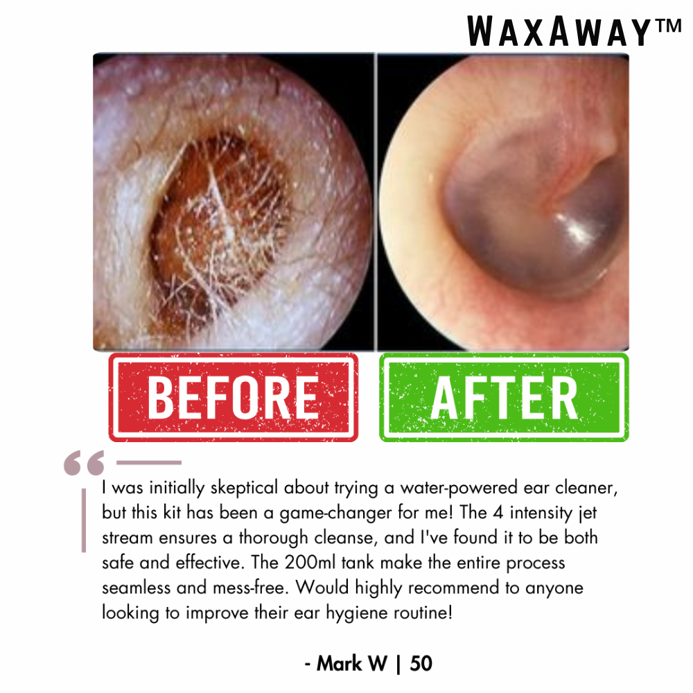 WaxAway™