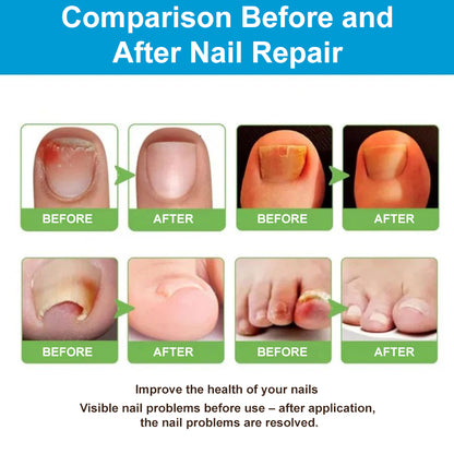 NailClear™