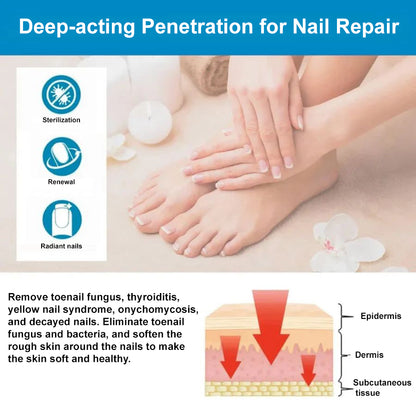 NailClear™